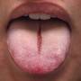 hsv_tongue.jpg